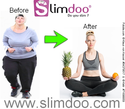before-after-slimdoo012